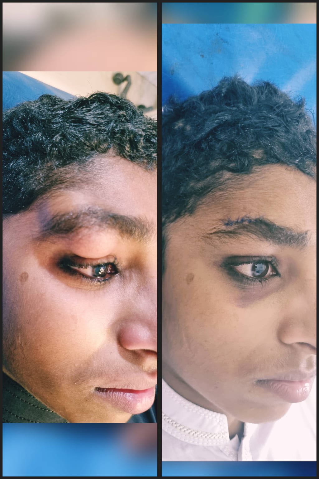 Before & After 49
